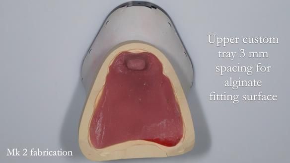 Replacing Madeline’s Complete denture FULL PROTOCOL