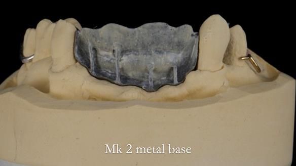 Newsletter 71 Jean’s Class I Mod III RPD: See my mistakes Fractured Mk1 to a Stronger Mk2 RPD (4 years on)