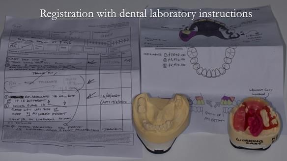 How Keith’s combat denture transformed his life – Newsletter 73