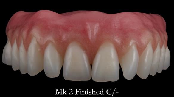 Replacing Madeline’s Complete denture FULL PROTOCOL