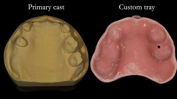 Newsletter 71 Jean’s Class I Mod III RPD: See my mistakes Fractured Mk1 to a Stronger Mk2 RPD (4 years on)