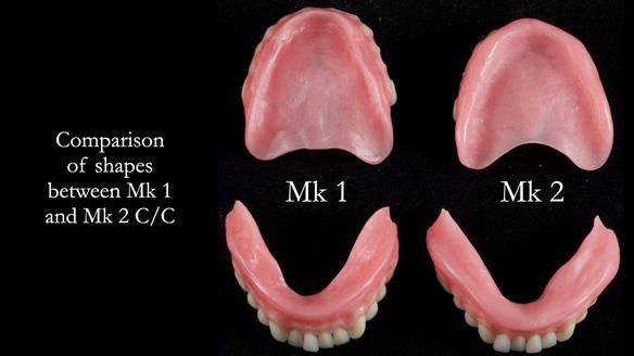 Replacing Madeline’s Complete denture FULL PROTOCOL