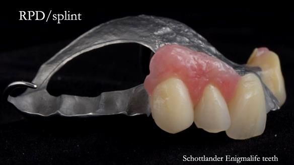 Read Newsletter 67 - Brian's COMBAT DENTURE Case Study