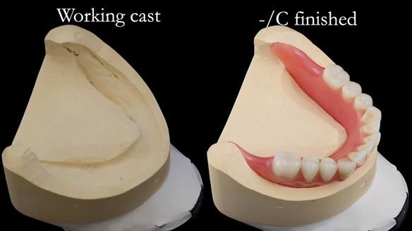 Replacing Madeline’s Complete denture FULL PROTOCOL