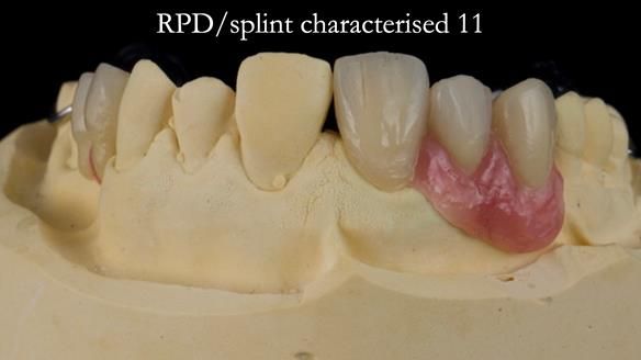 Read Newsletter 67 - Brian's COMBAT DENTURE Case Study