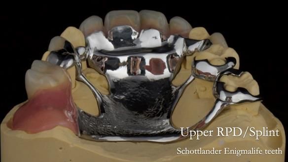 Newsletter 71 Jean’s Class I Mod III RPD: See my mistakes Fractured Mk1 to a Stronger Mk2 RPD (4 years on)