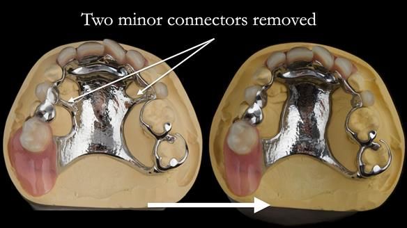 Newsletter 71 Jean’s Class I Mod III RPD: See my mistakes Fractured Mk1 to a Stronger Mk2 RPD (4 years on)