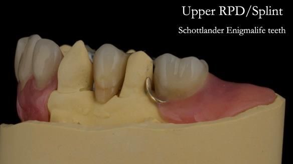 Newsletter 71 Jean’s Class I Mod III RPD: See my mistakes Fractured Mk1 to a Stronger Mk2 RPD (4 years on)