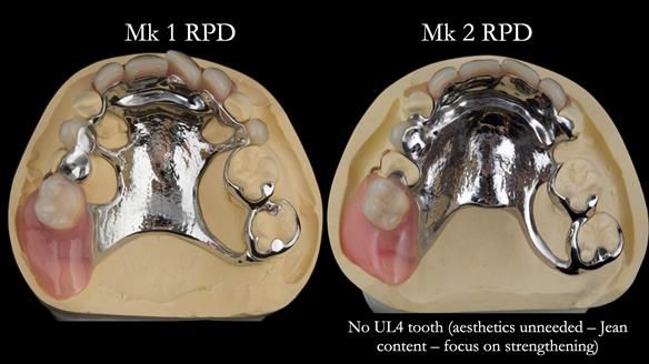 Newsletter 71 Jean’s Class I Mod III RPD: See my mistakes Fractured Mk1 to a Stronger Mk2 RPD (4 years on)