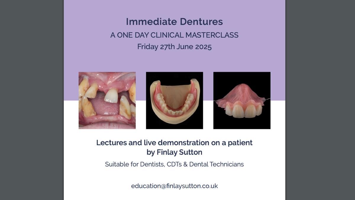 Newsletter 74: Ken’s Case Study Complete Dentures - Life Like and Age Appropriate