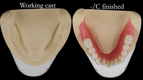 Replacing Madeline’s Complete denture FULL PROTOCOL