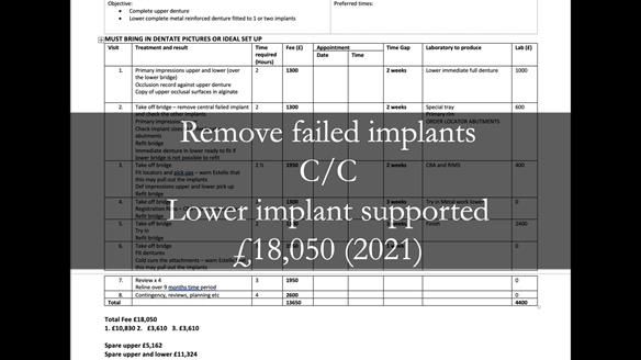 Newsletter 49 Managing Estelle’s failing implants with dentures FULL PROTOCOL