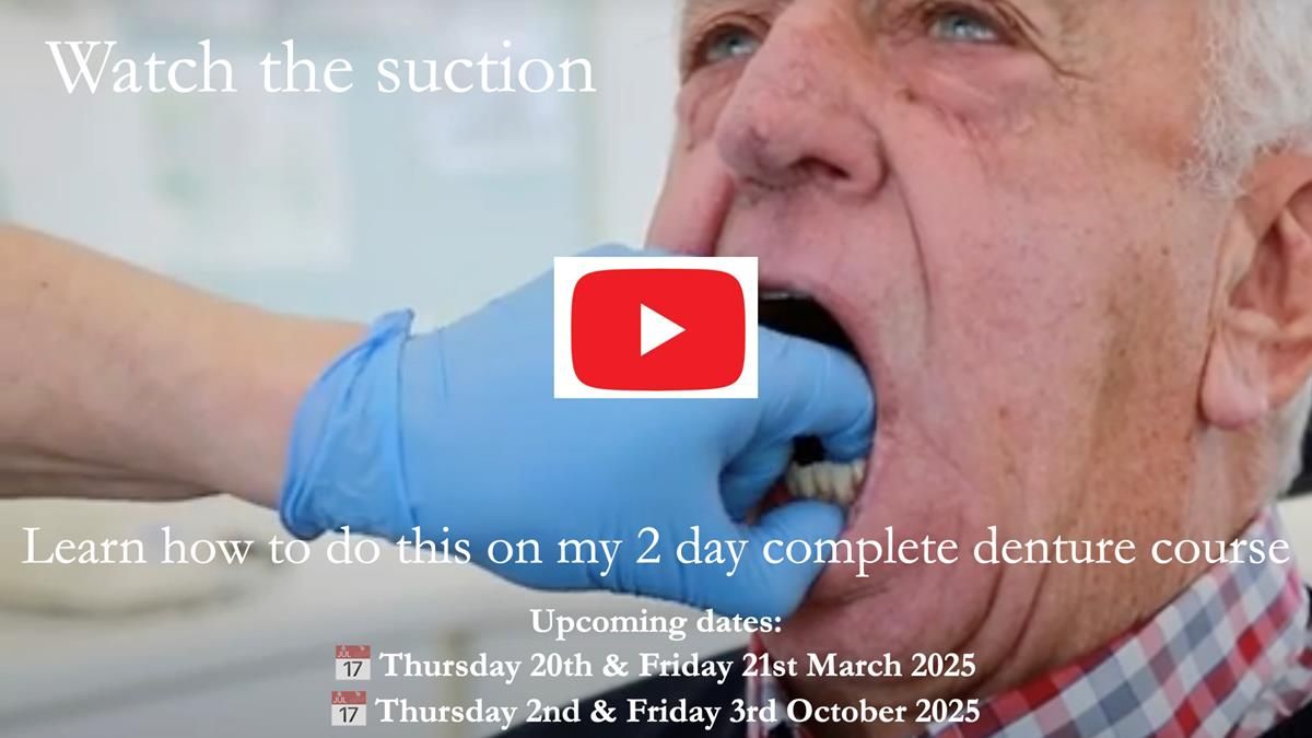 Newsletter 74: Ken’s Case Study Complete Dentures - Life Like and Age Appropriate