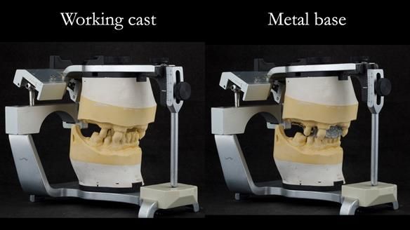 Newsletter 71 Jean’s Class I Mod III RPD: See my mistakes Fractured Mk1 to a Stronger Mk2 RPD (4 years on)