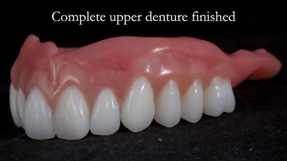 Newsletter 65 Marisa Provision of Complete Dentures on badly placed implants