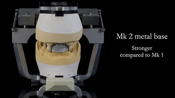 Newsletter 71 Jean’s Class I Mod III RPD: See my mistakes Fractured Mk1 to a Stronger Mk2 RPD (4 years on)