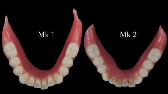 Replacing Madeline’s Complete denture FULL PROTOCOL