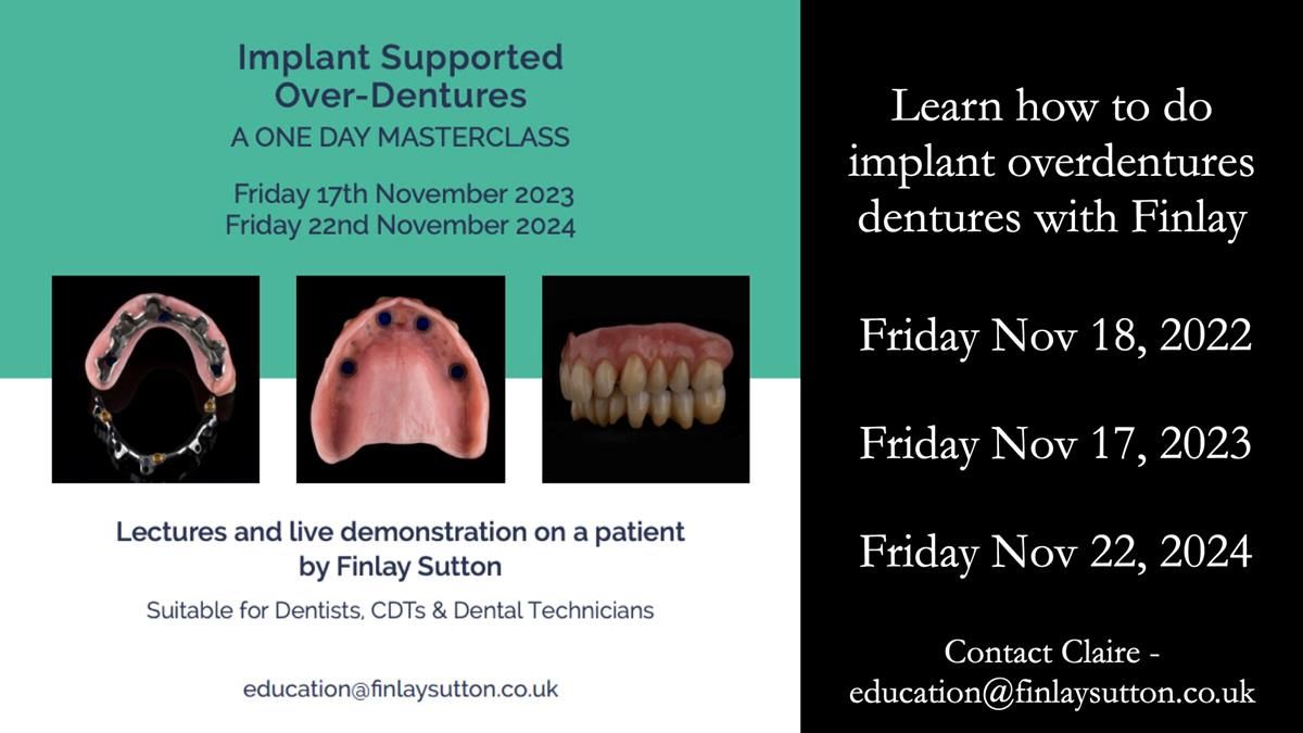 Newsletter 44 - extreme removable prosthodontics – engineering a super-strong and ultra-thin over denture