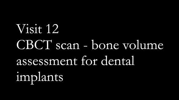 Replacing Madeline’s Complete denture FULL PROTOCOL