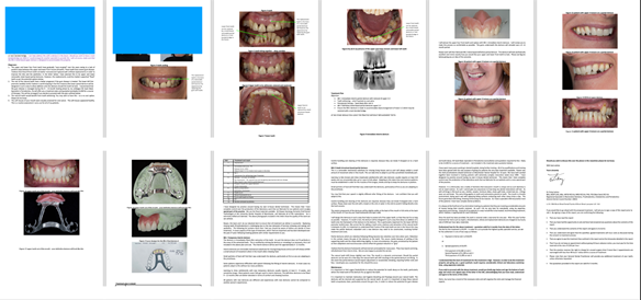 Figure 14 Treatment plan letter for the patient