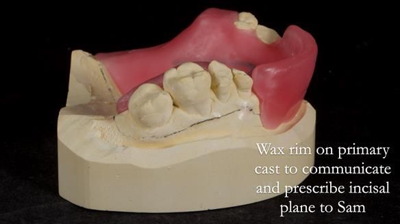 How Keith’s combat denture transformed his life – Newsletter 73