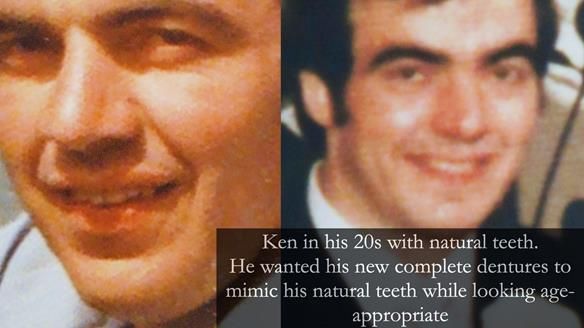 Newsletter 74: Ken’s Case Study Complete Dentures - Life Like and Age Appropriate