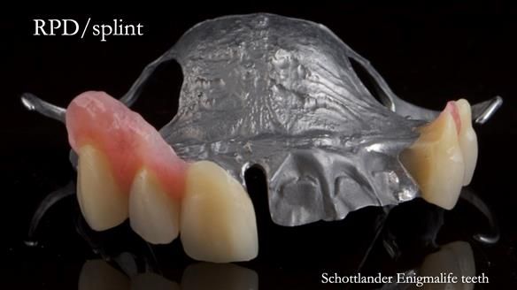 Read Newsletter 67 - Brian's COMBAT DENTURE Case Study