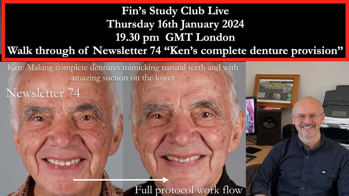 Fin’s Study Club Live – A walk-through of Newsletter 74: Ken’s complete denture provision. Demonstrating how to achieve exceptional lower suction with complete dentures. Click on this link at 7.30 am GMT on February 27th to join: https://us02web.zoom.us/