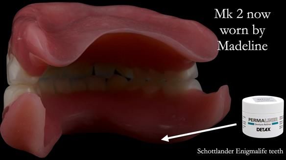 Replacing Madeline’s Complete denture FULL PROTOCOL