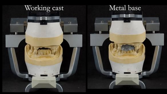 Newsletter 71 Jean’s Class I Mod III RPD: See my mistakes Fractured Mk1 to a Stronger Mk2 RPD (4 years on)