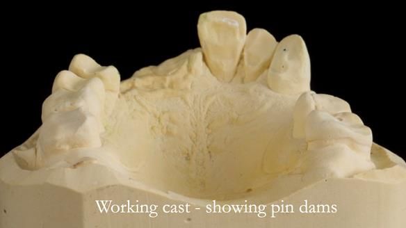 Read Newsletter 67 - Brian's COMBAT DENTURE Case Study