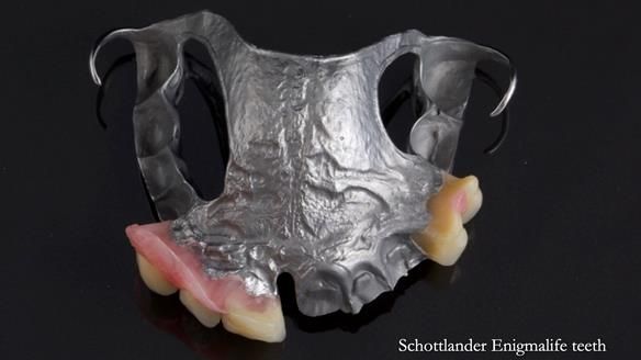 Read Newsletter 67 - Brian's COMBAT DENTURE Case Study