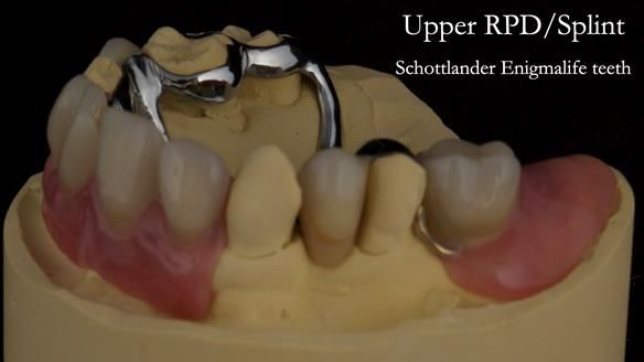 Newsletter 71 Jean’s Class I Mod III RPD: See my mistakes Fractured Mk1 to a Stronger Mk2 RPD (4 years on)