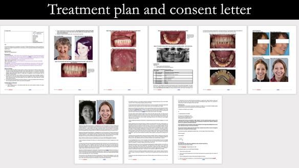 Solving Linda’s Failed “All on 4” implant bridges - full protocol Newsletter 42