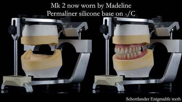 Replacing Madeline’s Complete denture FULL PROTOCOL