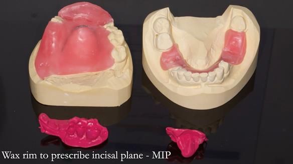 How Keith’s combat denture transformed his life – Newsletter 73