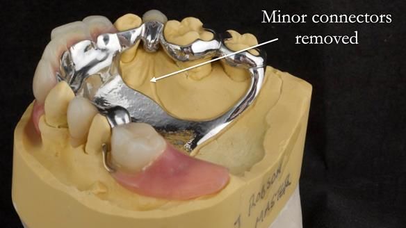 Newsletter 71 Jean’s Class I Mod III RPD: See my mistakes Fractured Mk1 to a Stronger Mk2 RPD (4 years on)