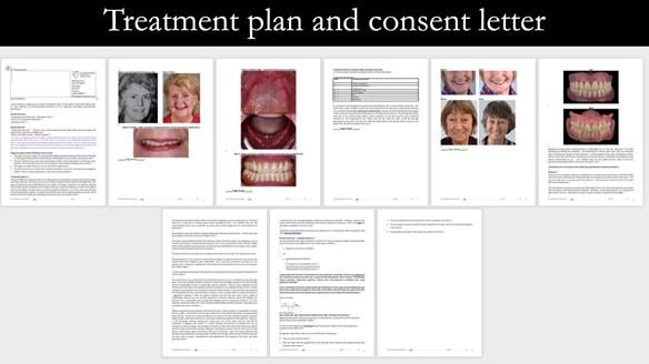 Replacing Madeline’s Complete denture FULL PROTOCOL