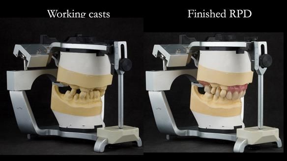 Newsletter 71 Jean’s Class I Mod III RPD: See my mistakes Fractured Mk1 to a Stronger Mk2 RPD (4 years on)