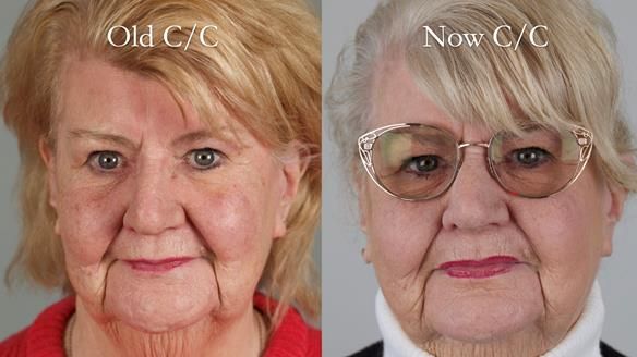 Replacing Madeline’s Complete denture FULL PROTOCOL