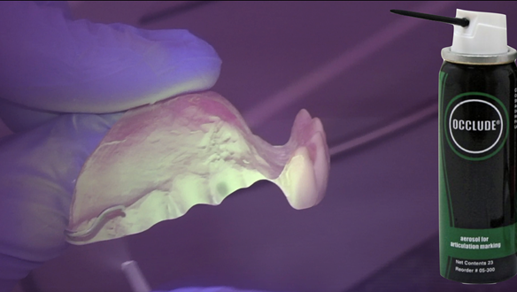 Figure 30 Occlude spray is used to check the fit of the collets