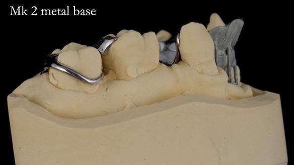 Newsletter 71 Jean’s Class I Mod III RPD: See my mistakes Fractured Mk1 to a Stronger Mk2 RPD (4 years on)