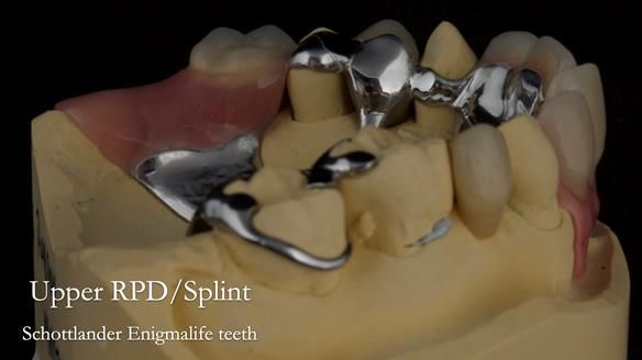 Newsletter 71 Jean’s Class I Mod III RPD: See my mistakes Fractured Mk1 to a Stronger Mk2 RPD (4 years on)