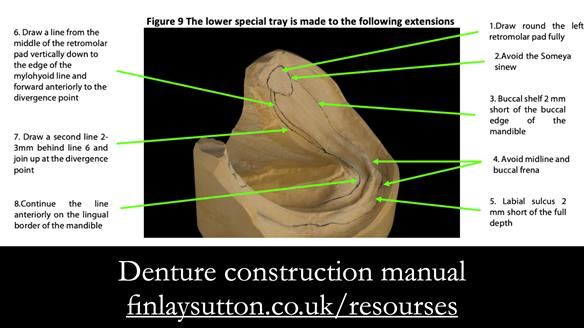 Newsletter 74: Ken’s Case Study Complete Dentures - Life Like and Age Appropriate