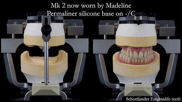 Replacing Madeline’s Complete denture FULL PROTOCOL