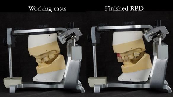 Newsletter 71 Jean’s Class I Mod III RPD: See my mistakes Fractured Mk1 to a Stronger Mk2 RPD (4 years on)