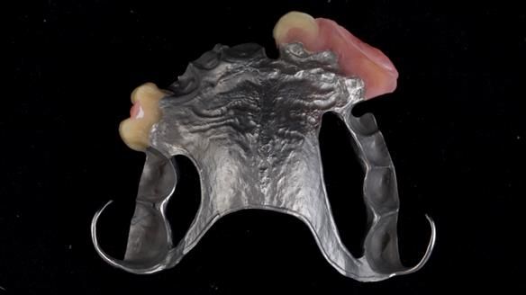 Read Newsletter 67 - Brian's COMBAT DENTURE Case Study