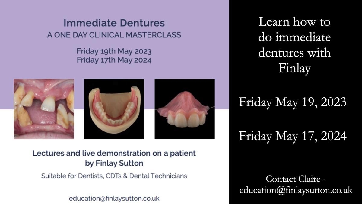 Newsletter 44 - extreme removable prosthodontics – engineering a super-strong and ultra-thin over denture