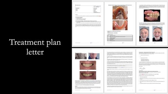 Newsletter 74: Ken’s Case Study Complete Dentures - Life Like and Age Appropriate