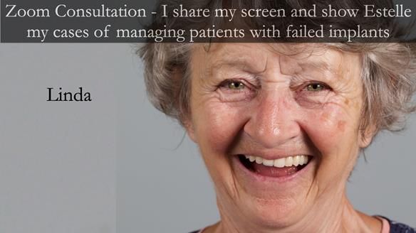 Newsletter 49 Managing Estelle’s failing implants with dentures FULL PROTOCOL